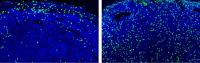 CD8+ cytotoxic T cells (green) infiltrate breast cancer tumors in animal models, showing that the dual-drug therapy stimulates the body’s immune response against the cancer.